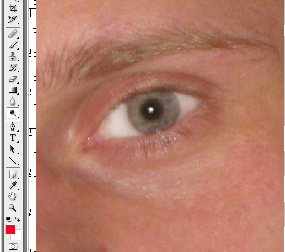 Результат осветления белка глаз